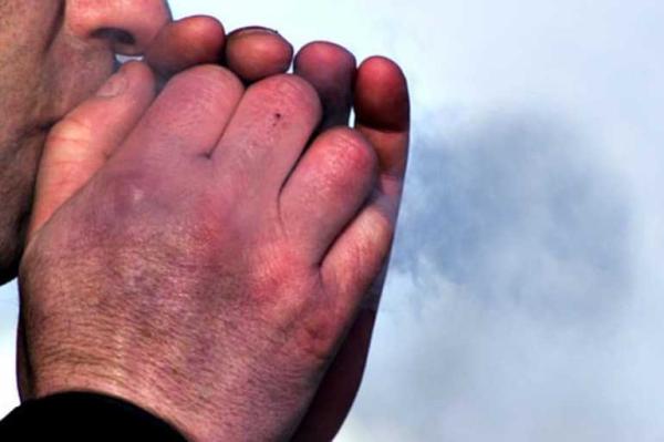 Цаг агаар эрс хүйтэрч осголт, хөлдөлт их байгаа тул хөлдөлтөөс урьдчилан сэргийлээрэй.